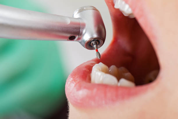 Best Broken or Cracked Tooth Emergency Dentist in Cheree, OK